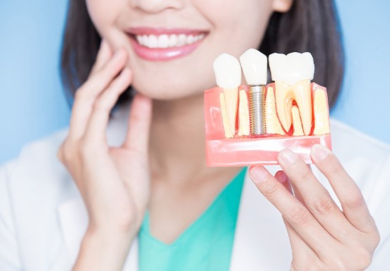 A close up of a dental implant model held by a dentist