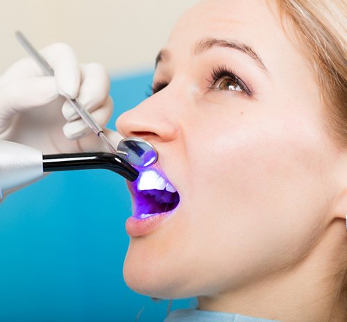 a patient undergoing direct bonding treatment