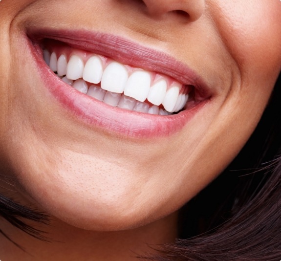 Close up of smile with flawless teeth