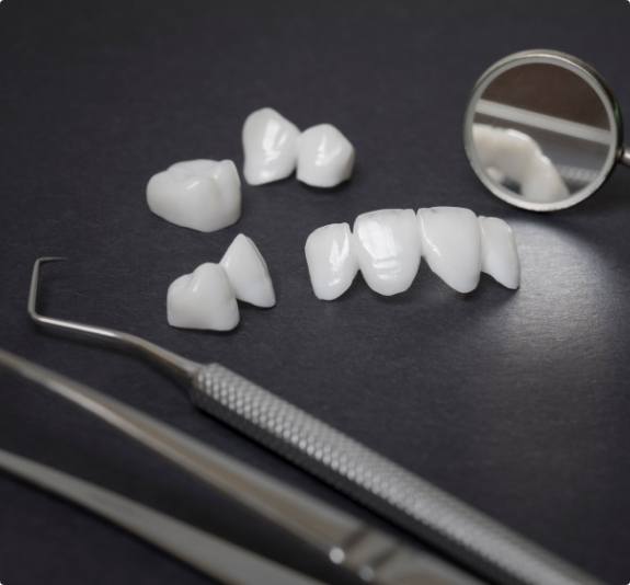 Several dental crowns and veneers on table