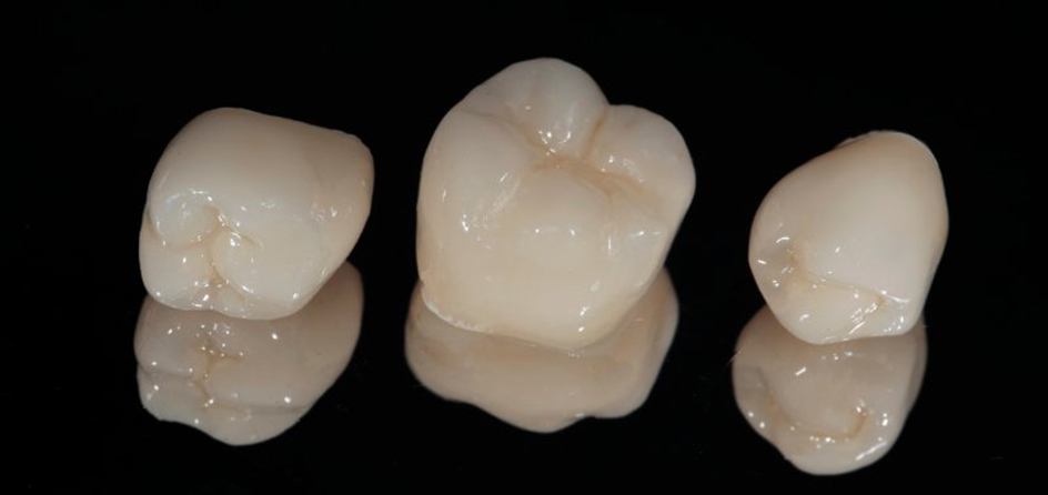 Dental crowns