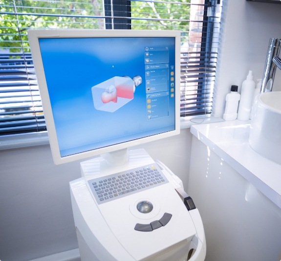 Computer monitor with digital 3 D model of a tooth